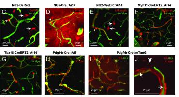 Practical guide to live imaging of brain pericytes